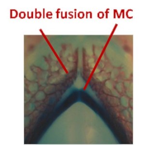 Alligator Meckel's cartilage